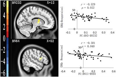 The relationship between childhood emotional neglect experience and depressive symptoms and prefrontal resting functional connections in college students: The mediating role of reappraisal strategy